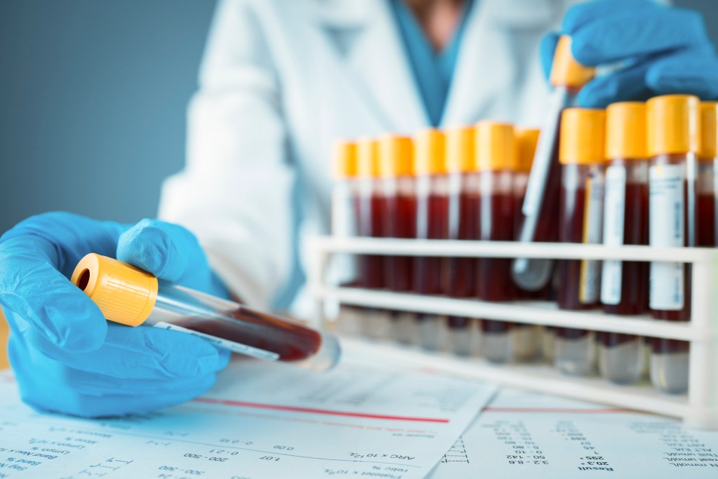 A blood test could be released soon that would tell us who has immunity to COVID-19. Image via iStock